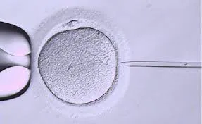 Intracytoplasmic sperm injection vs Conventional IVF: Which should you do??