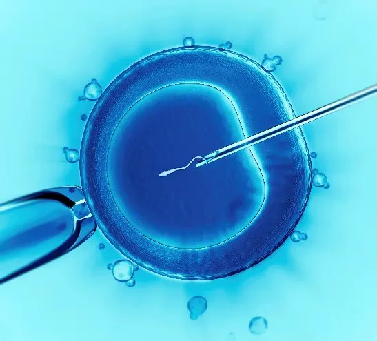 Understanding the Basics of IVF